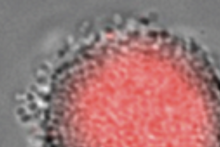 Towards entry "How bacteria form heterogeneous colonies?"